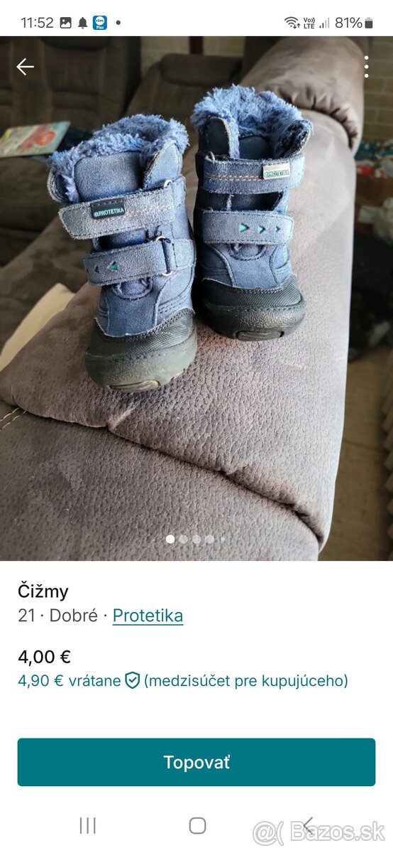 Zimné topanky čižmy 21 protetika