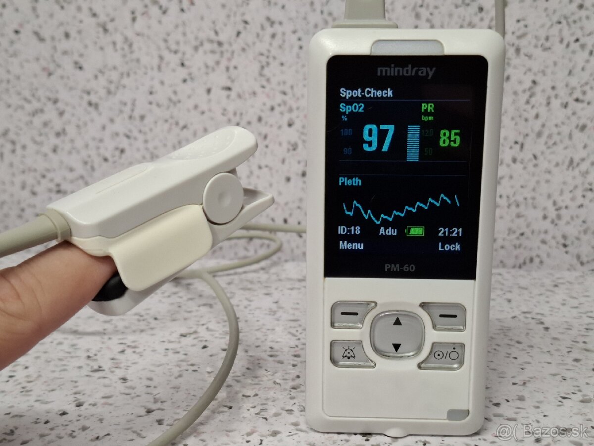 MINDRAY PM-60 》prenosný pulzný oxymeter Mindray PM-60