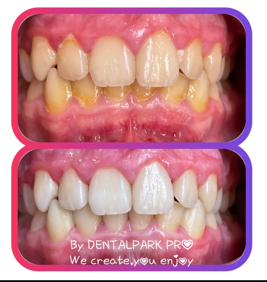Dentalna hygienička, preventistka