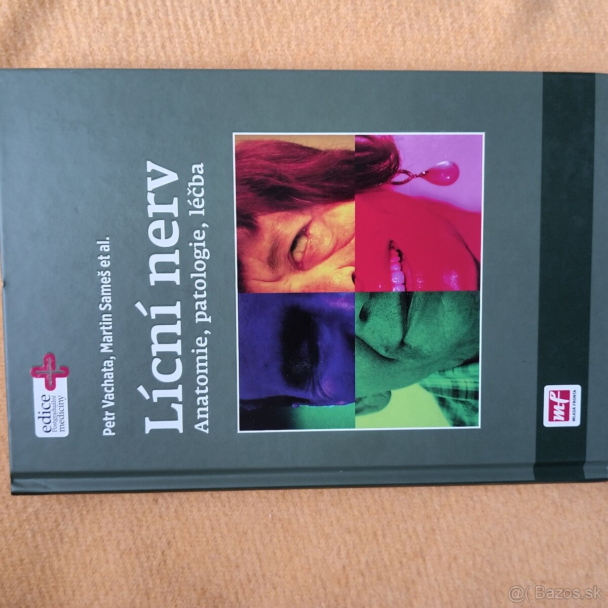 Lícní nerv: Anatomie, patologie, léčba.