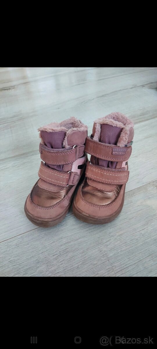 Protetika čižmy 21ky