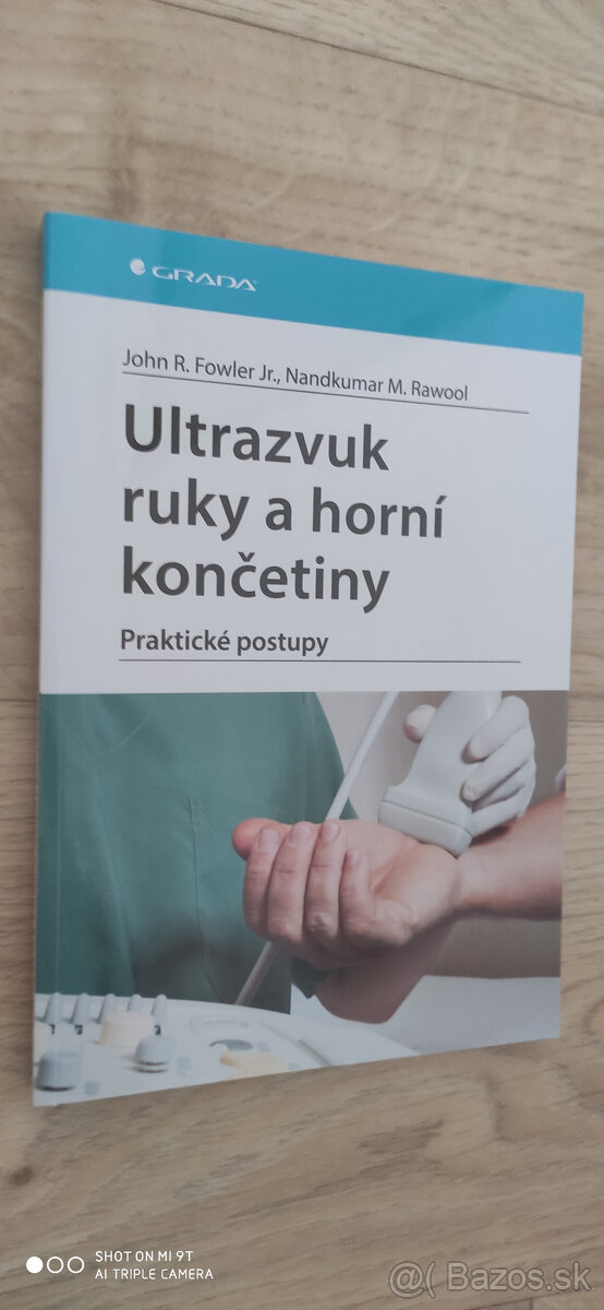 Ultrazvuk ruky a horní končetiny -Fowler R. john
