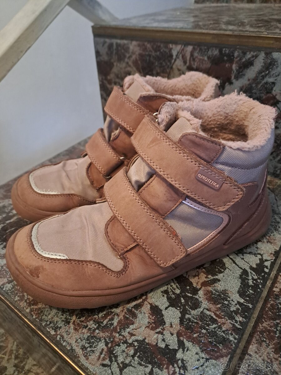 Protetika zimna obuv