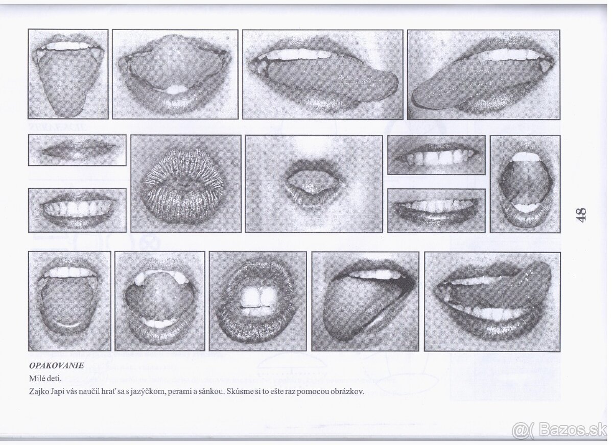 logopedia po cievnych prihodach