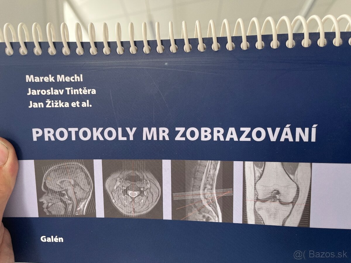 Protokoly MR zobrazovaní 1 vydanie