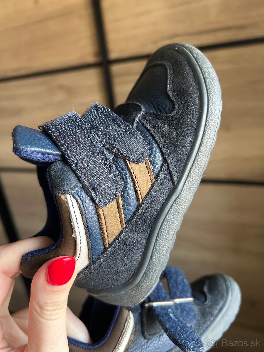 Predám topánky PROTETIKA 22