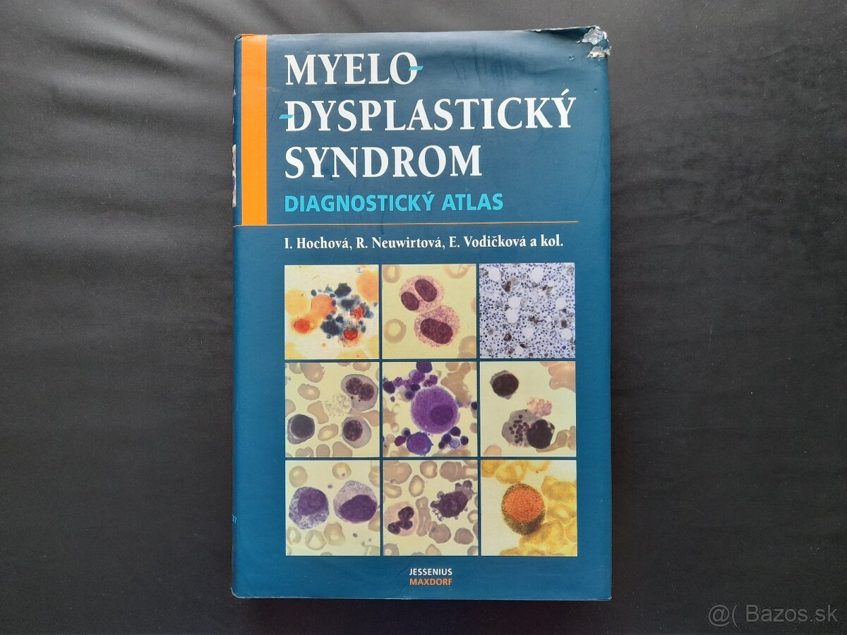 Myelodysplastický syndrom - Diagnostický atlas