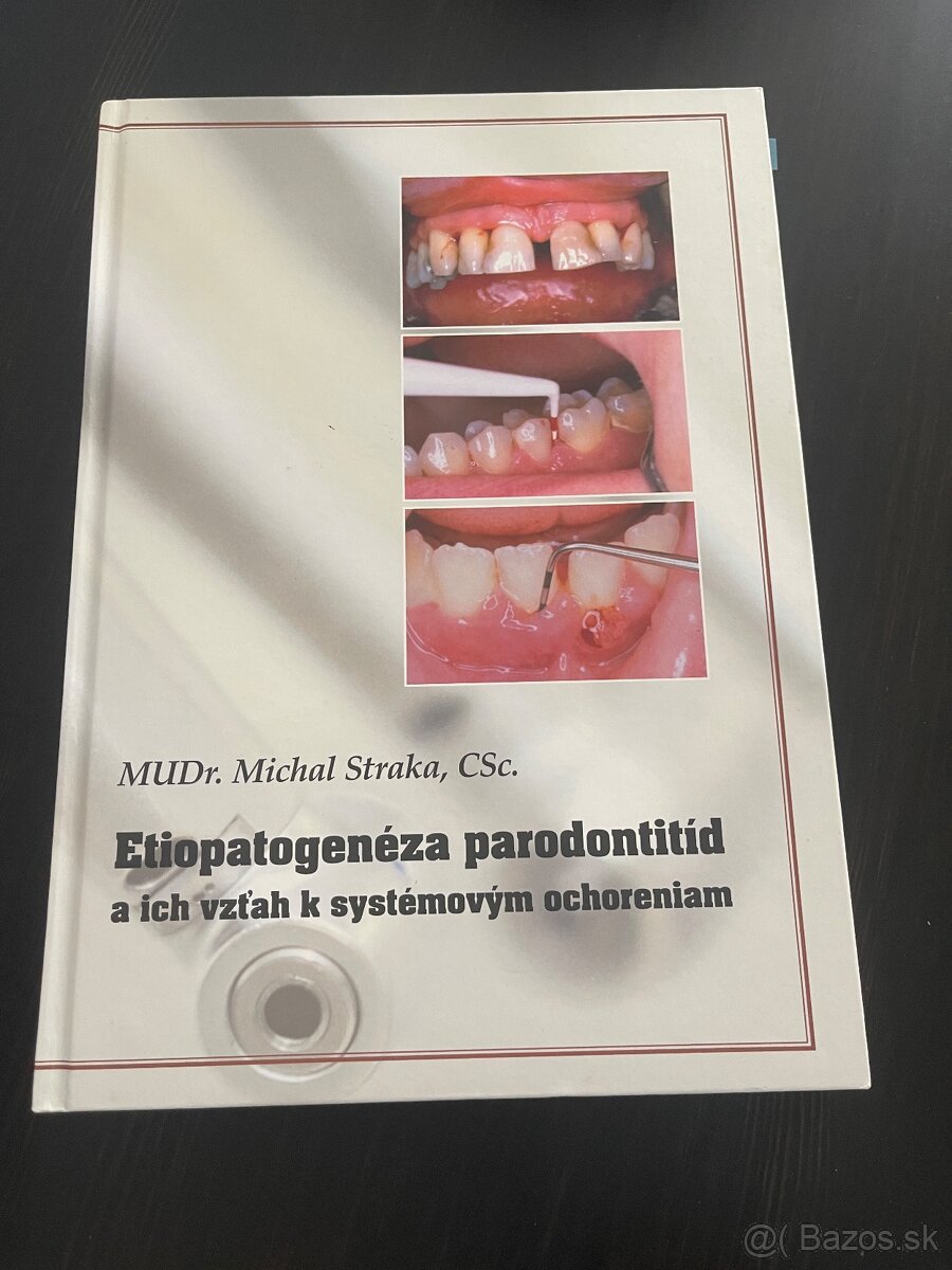 Etiopatogenéza parodontitíd Dentálna hygiena