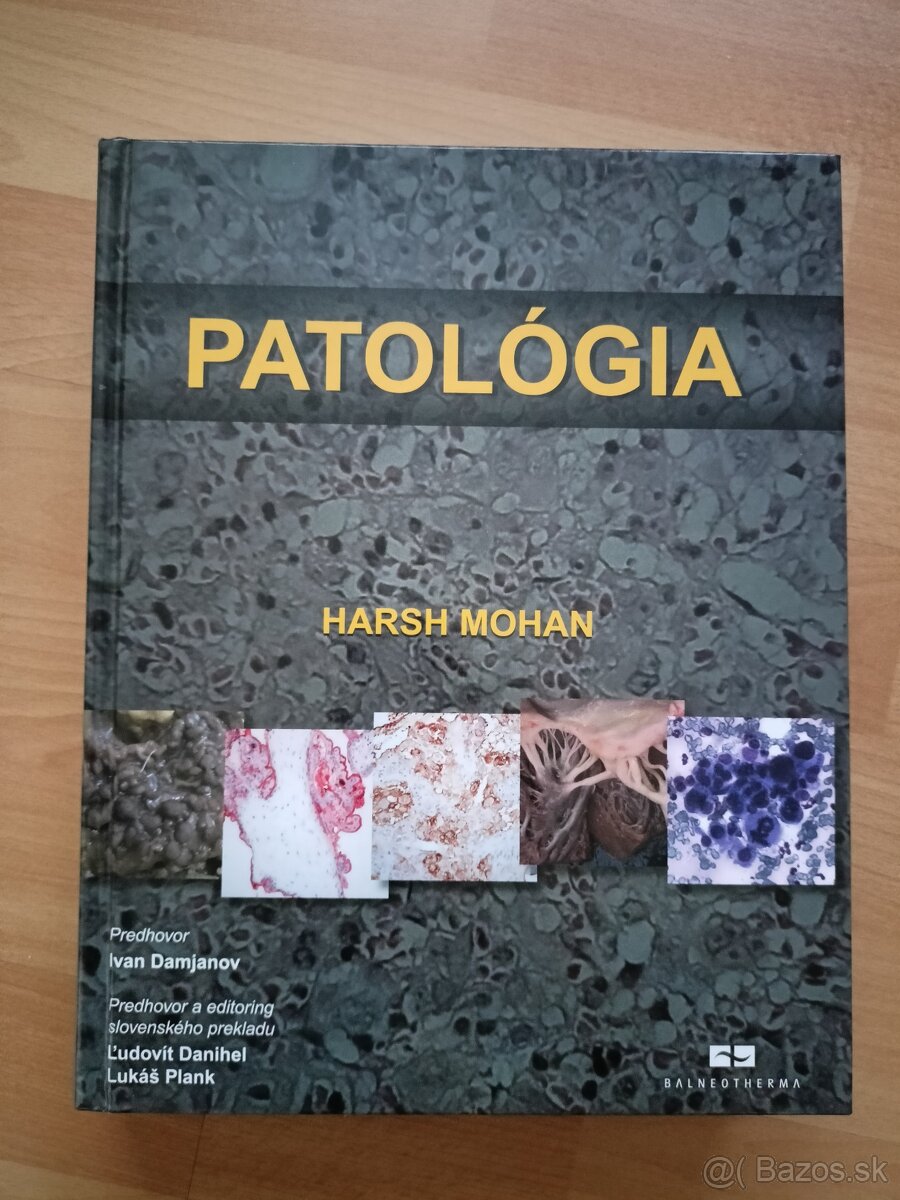 Mohan: Patologia