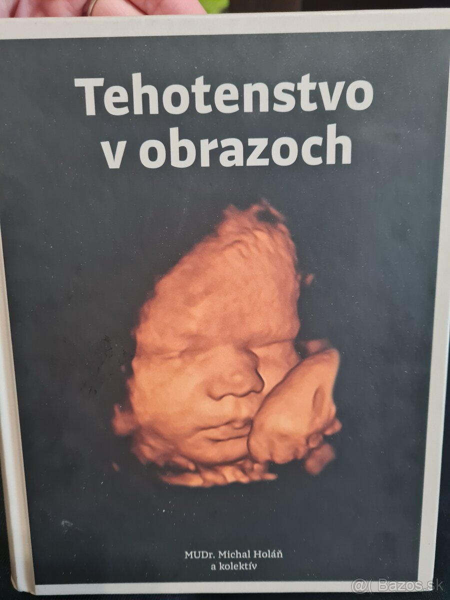 Kniha Tehotenstvo v obrazoch