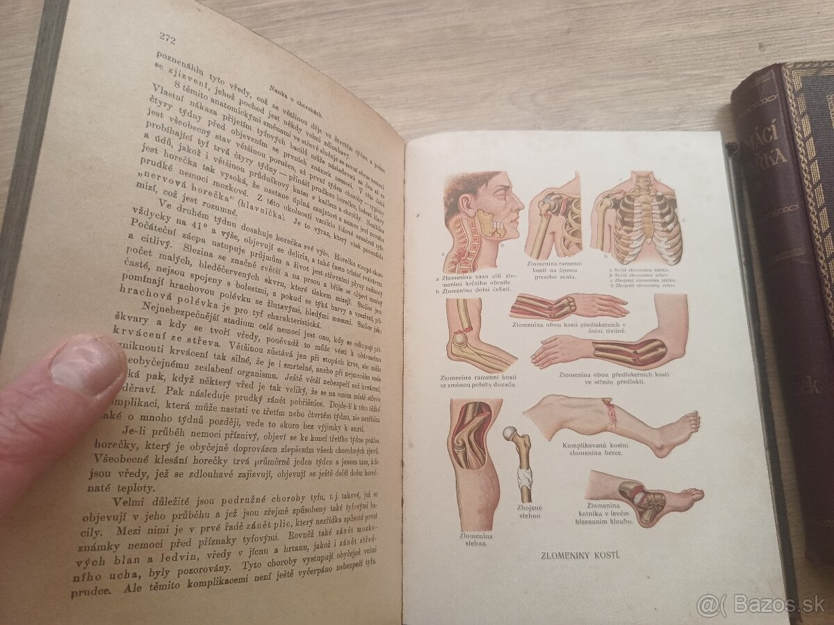 Jenny Springerová: Domáci lekárka I.,II., 1925 + rozkladacie - 10