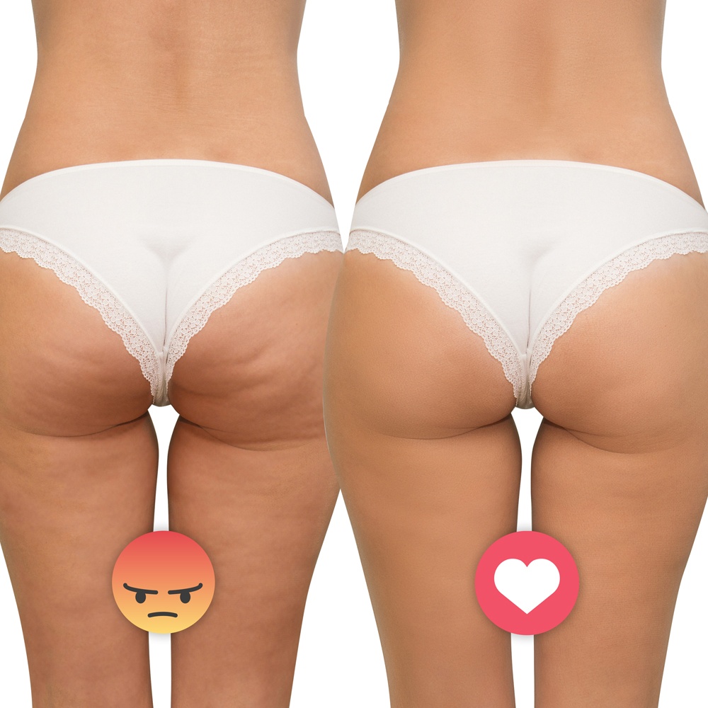 Ultrasonický masážny prístroj inSPORTline Valeri - 10