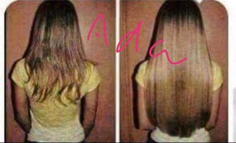 Cesnakový šampón 13e za 2ks - 10