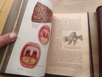 Jenny Springerová: Domáci lekárka I.,II., 1925 + rozkladací - 10