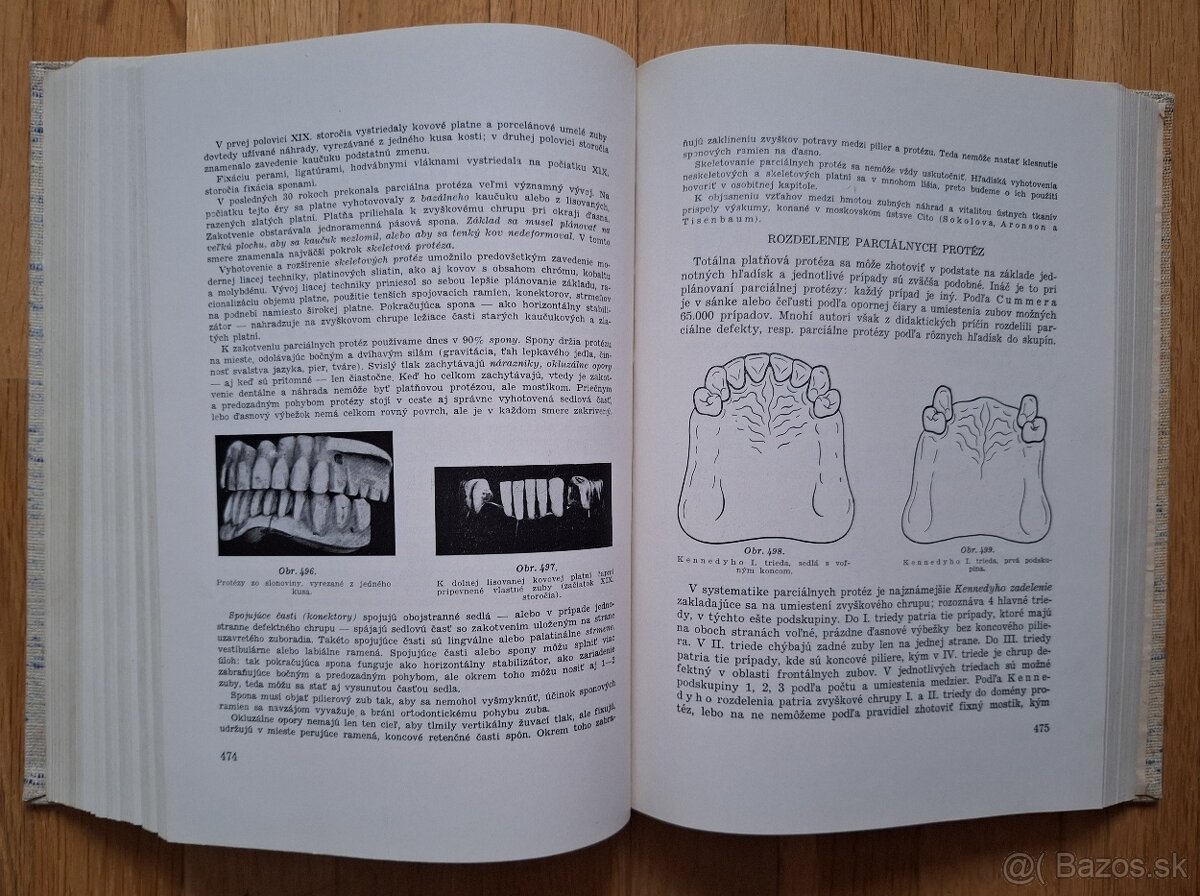 Zubna protetika - 11