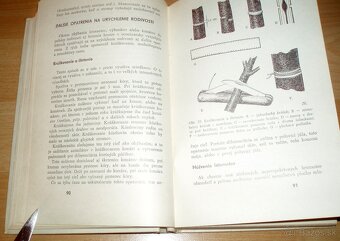 Rez a tvarovanie ovocných drevín - 11