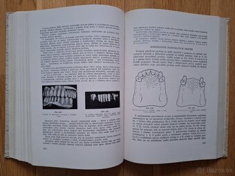 Zubna protetika - 11