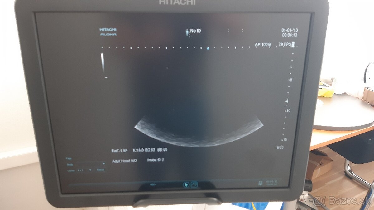 Ultrazvukový prístroj HITACHI ALOKA ARIETTA v70 - 12