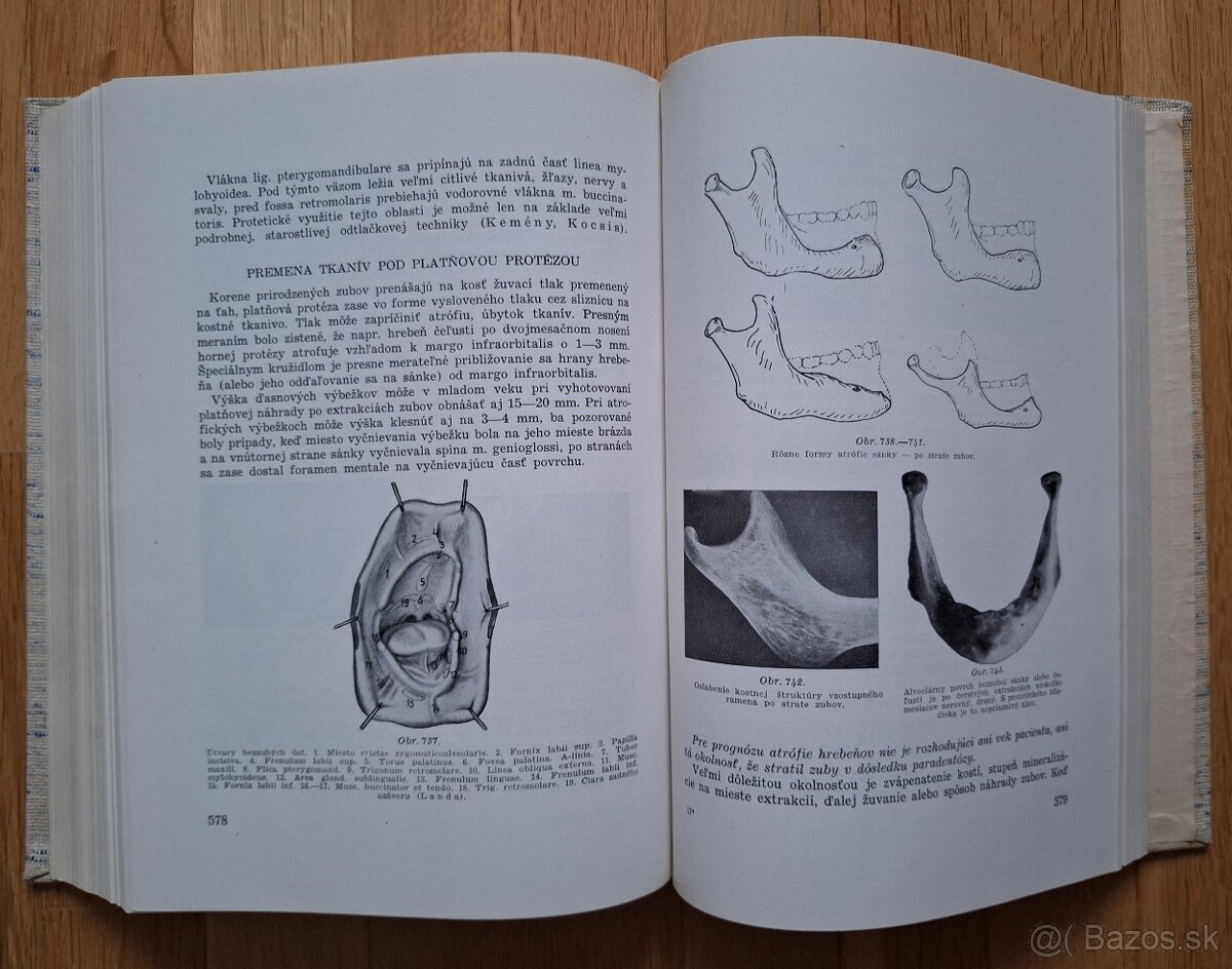 Zubna protetika - 12