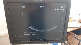 Ultrazvukový prístroj HITACHI ALOKA ARIETTA v70 - 12