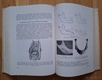 Zubna protetika - 12