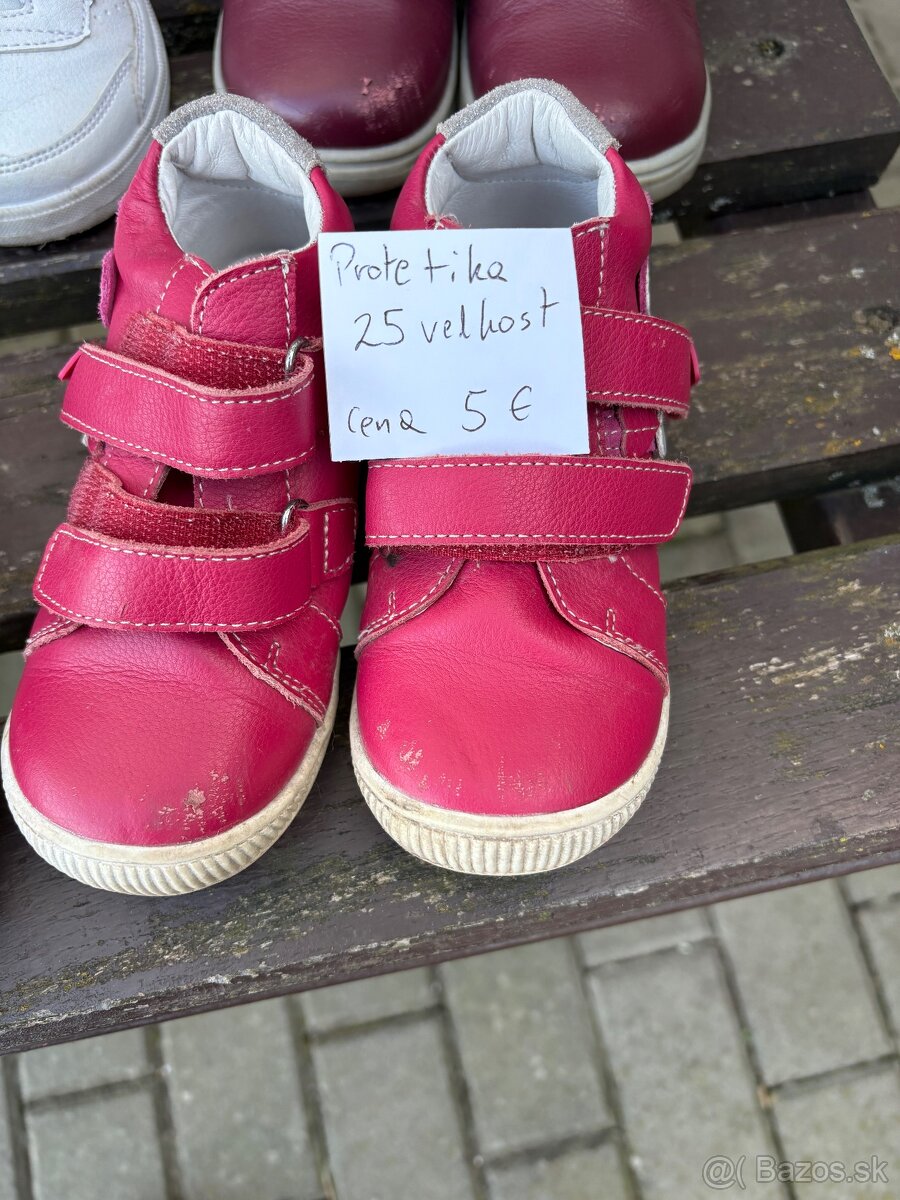 Detska obuv Memo, Adidas,Lasocki, Protetika - 13