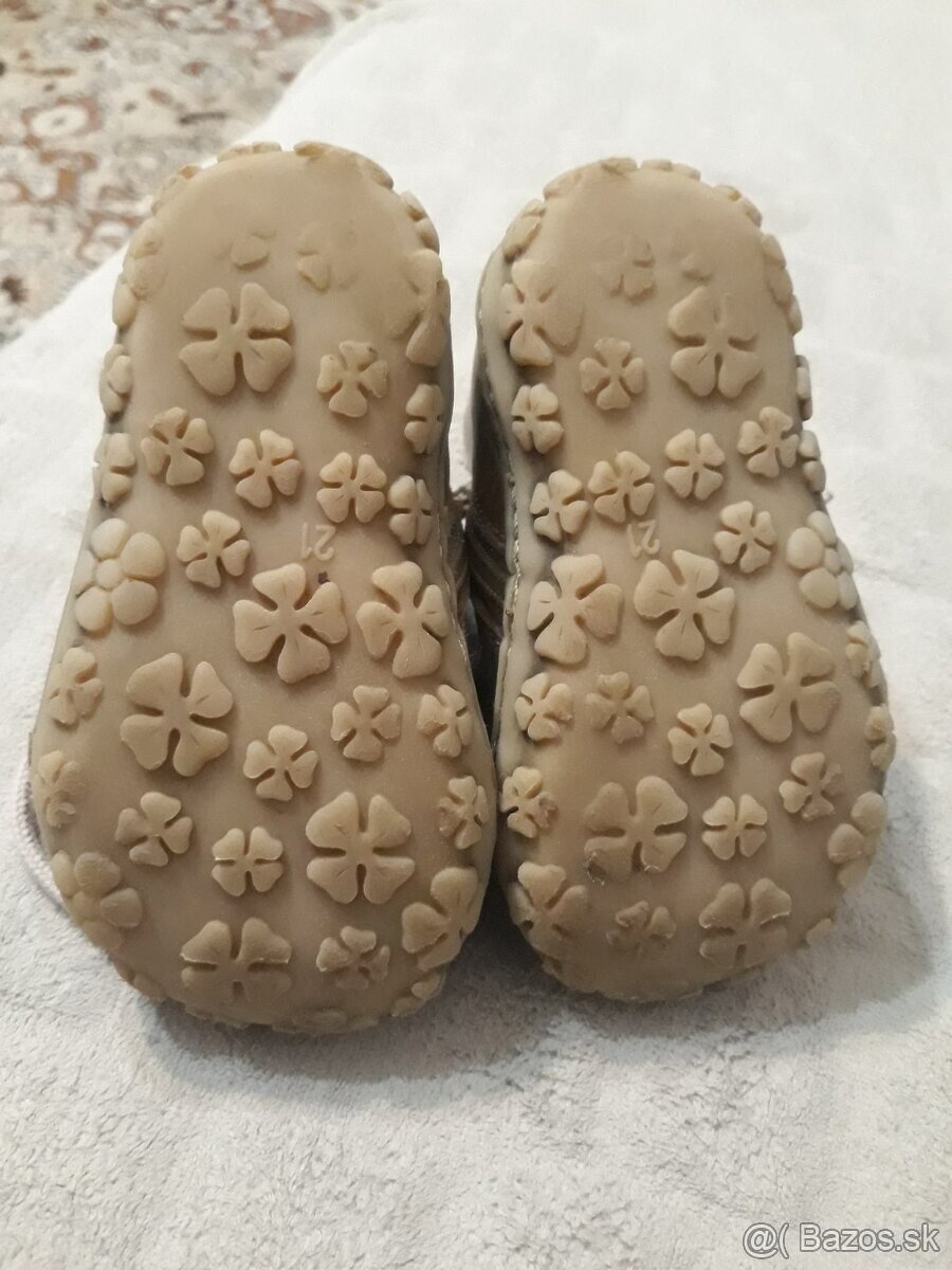 Prechodné topánky Protetika v.21 - 2ks - 13