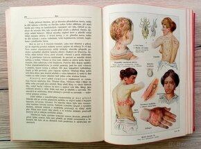 Nový lékařský rádce, starožitná lékařská kniha ze 20. let - 14