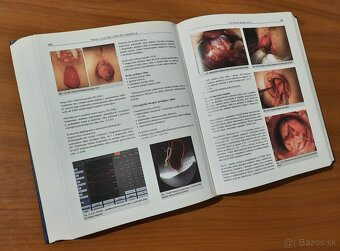 Princípy chirurgie I – III + Detská chirurgia (KOMPLET) - 16