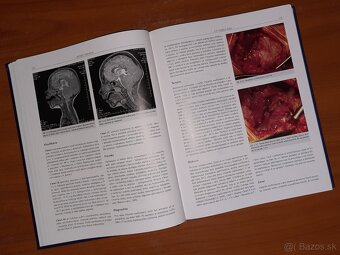Princípy chirurgie I – III + Detská chirurgia (KOMPLET) - 18