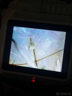 Pristroj na pokožku