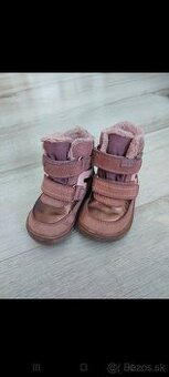 Protetika čižmy 21ky