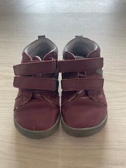 Prechodne topanky Protetika