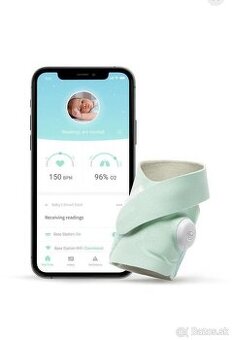 Owlet Smart Sock 3, záruka 21 mesiacov