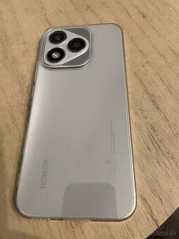 Honor 400 lite