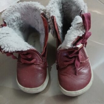 Zimne topanky protetika 25