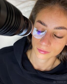 Uv lampa na mihalnice