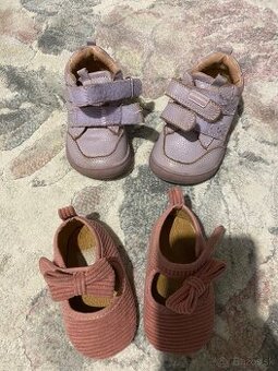 Protetika topánočky