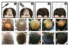 50g NAPLN NA ZAHUSTENIE VLASOV (napr. pre Toppik, Nanogen..)