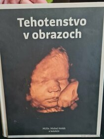Kniha Tehotenstvo v obrazoch