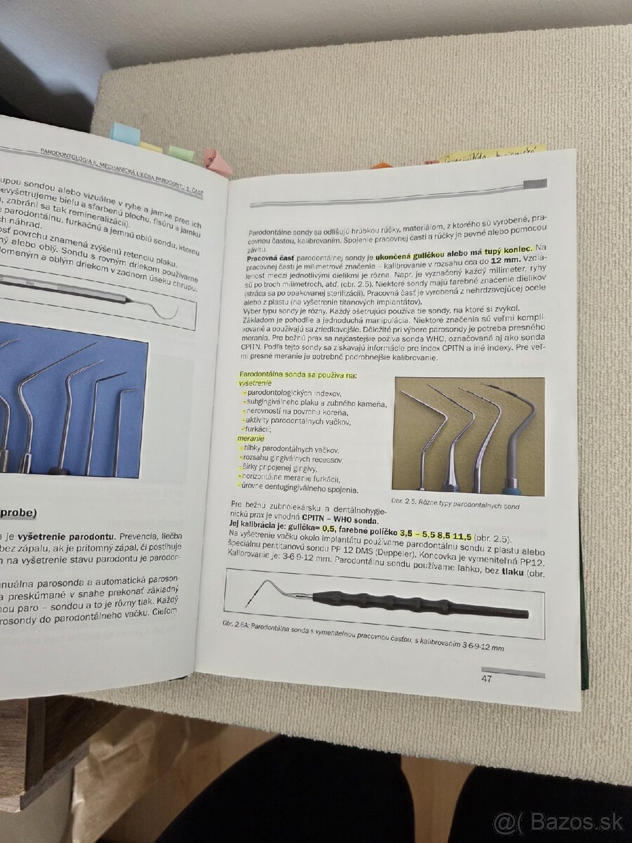 Parodontológia 2 II - 2