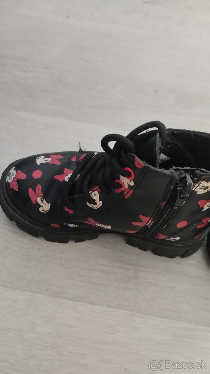 detske topanky - 2