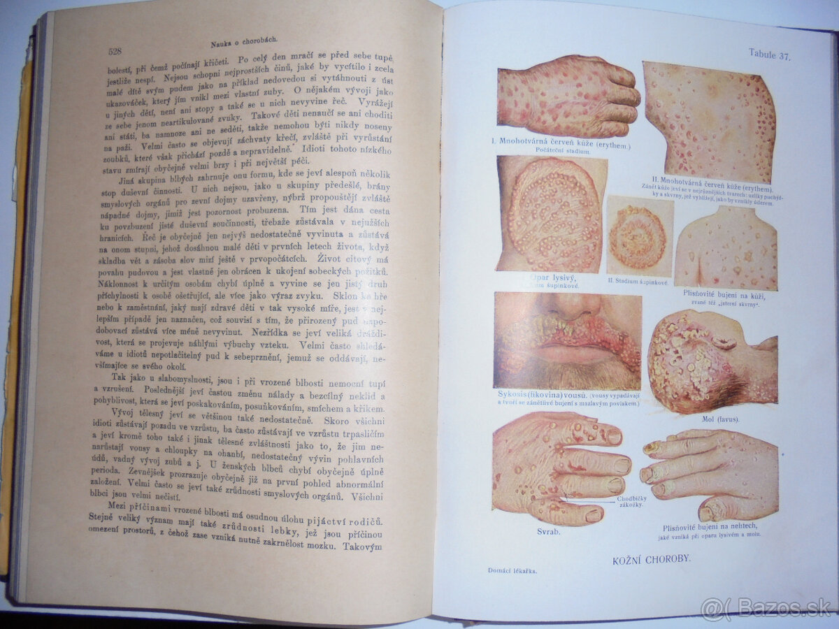 STAROŽITNÉ LEKÁRSKE KNIHY - 2