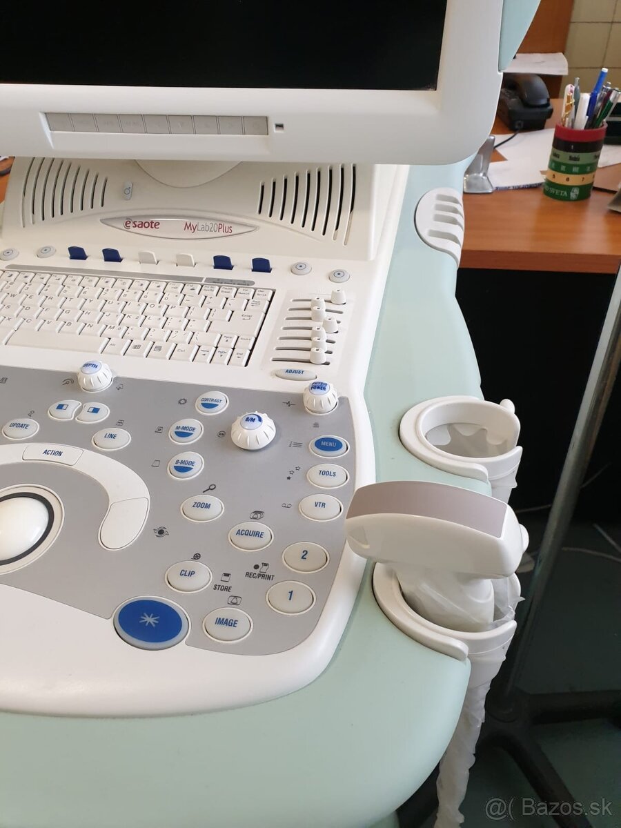 ultrazvuk Esaote 20 - 2