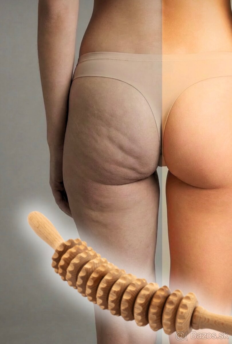 Maderoterapia Topoľčany - 2