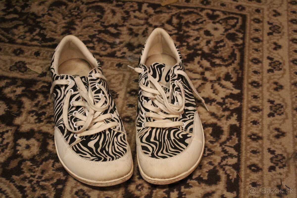 Be Lenka barefoot - 2