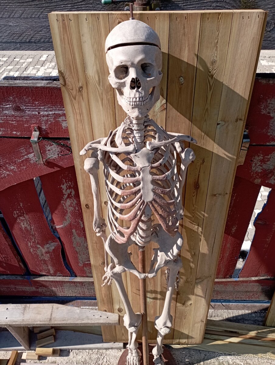 Kostra človeka. Starožitná - 2