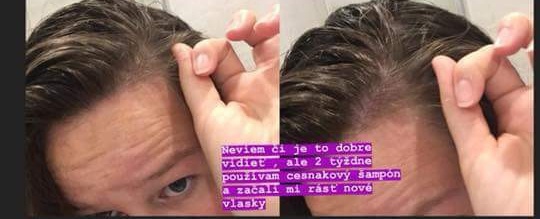 Cesnakový šampón 13e za 2ks - 2