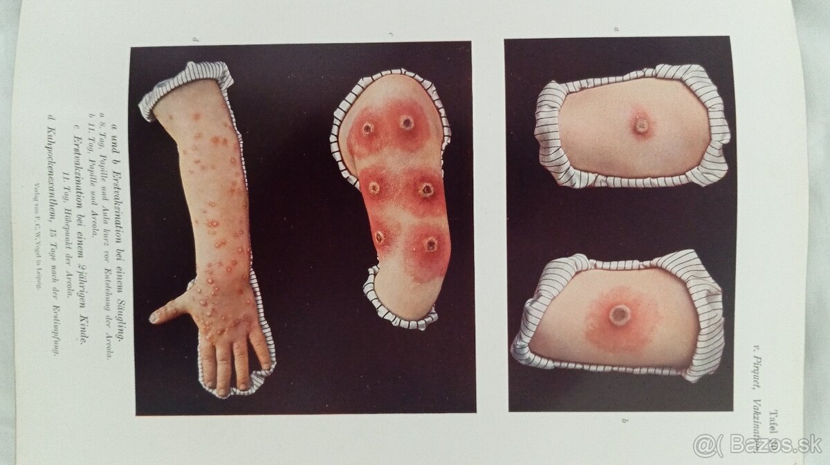 Staré lekarske knihy - 2