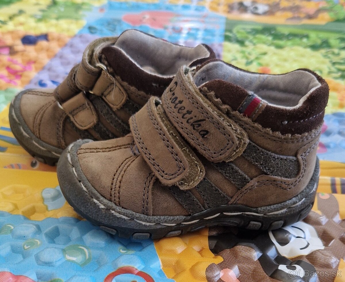 Topanky Protetika - 2